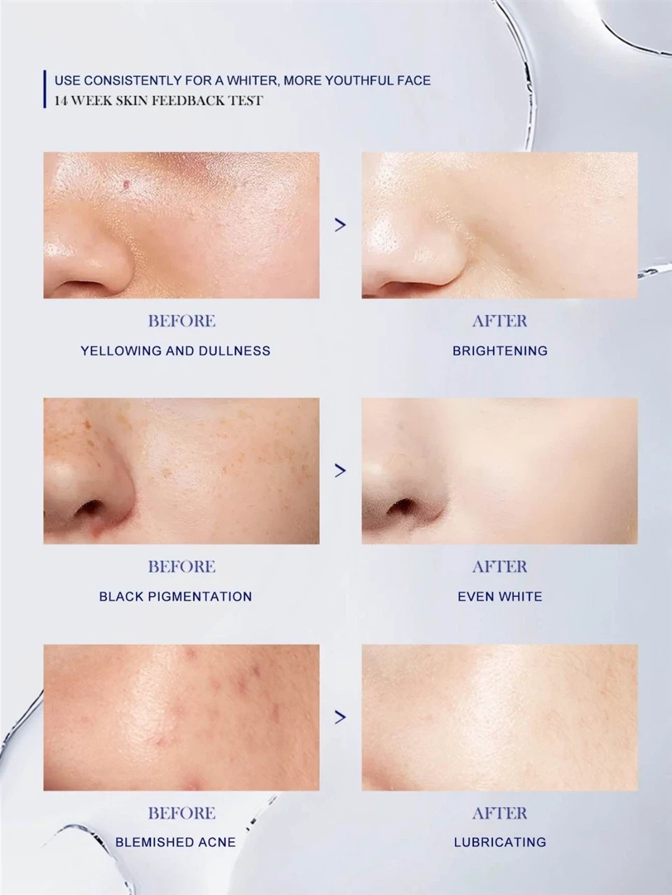 Brightening Anti Aging Whitening Skin Care Set